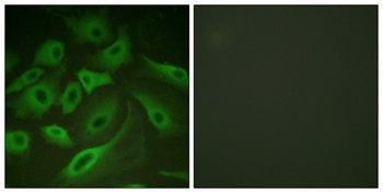 PLB antibody