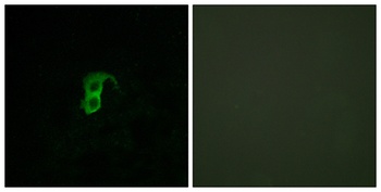 GPR87 antibody