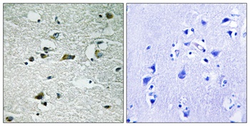 Casein Kinase I gamma 1/2/3 (phospho-Tyr263) antibody