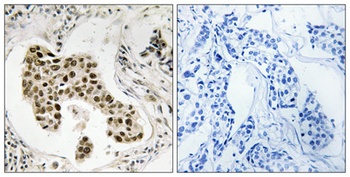 PMS2/PMS2CL rabbit pAb