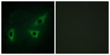 ATP7B antibody