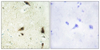 CHRAC15 rabbit pAb