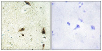 CHRAC15 antibody