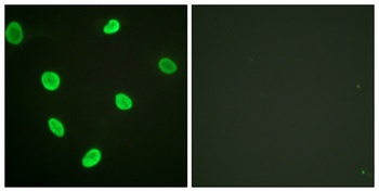 Acetyl Histone H2B (K12) rabbit pAb