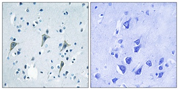GPR85 rabbit pAb Antibody