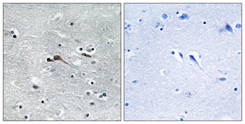 CYTL1 antibody