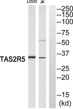 T2R5 rabbit pAb