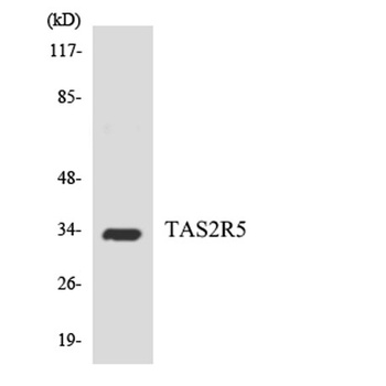 T2R5 rabbit pAb Antibody