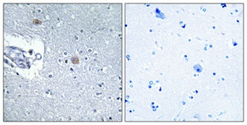 CSGlcA-T rabbit pAb