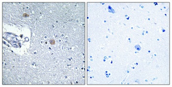 CSGlcA-T antibody