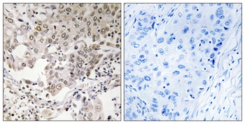 hCAP-G2 antibody