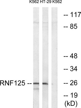 TRAC-1 antibody
