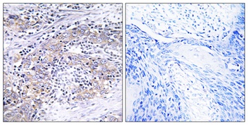 CLN6 antibody