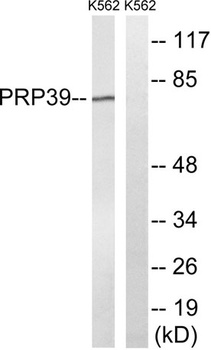 PRPF39 rabbit pAb