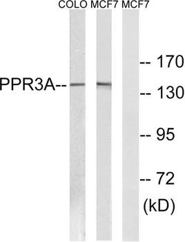 PPP1R3A rabbit pAb Antibody