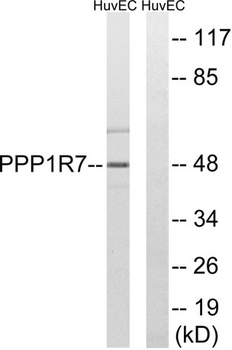 Sds22 antibody