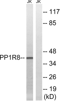 NIPP1 rabbit pAb