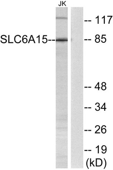 SLC6A15 rabbit pAb