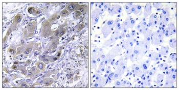 MRP-S18A antibody