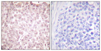 CLLD7 antibody