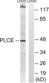 LPAAT-Epsilon antibody