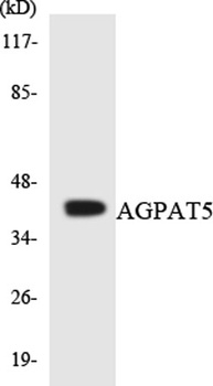 LPAAT-ε rabbit pAb Antibody