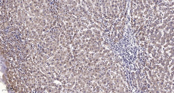 LPAAT-ε rabbit pAb Antibody