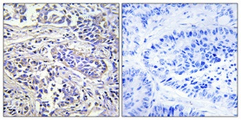 PLC-XD1 antibody