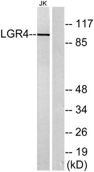 GPR48 antibody