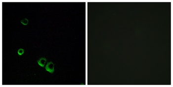 AVP Receptor V2 rabbit pAb