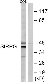 CD172g antibody