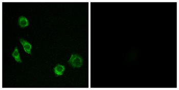 GPRC5D antibody