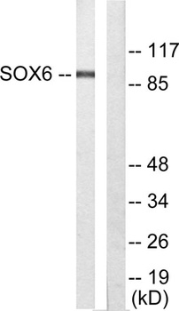Sox-6 antibody