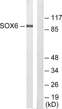 Sox-6 rabbit pAb