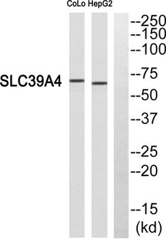 ZIP4 rabbit pAb Antibody