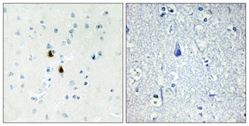 Pki α rabbit pAb Antibody