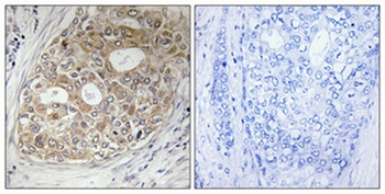 ARF GAP1 antibody