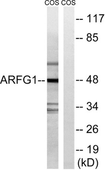 ARF GAP1 rabbit pAb Antibody