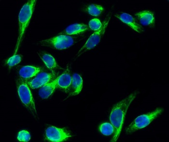 PKC (phospho Thr497) rabbit pAb