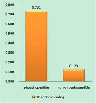 PKC β (phospho Ser661) rabbit pAb