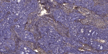 PKC ε rabbit pAb Antibody