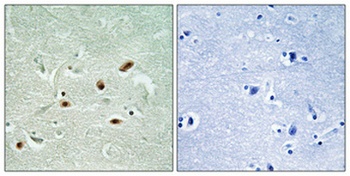 DNA-PKCS (phospho Ser2612) rabbit pAb