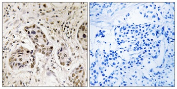 RCC2 antibody