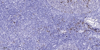 cGKII (phospho-Ser126) antibody