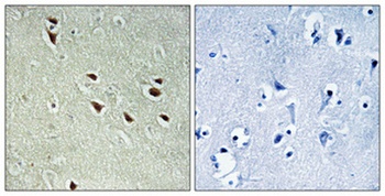 NXF3 antibody