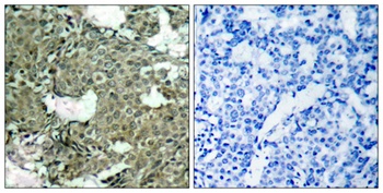 MEK-1/2 (phospho-Ser222/226) antibody