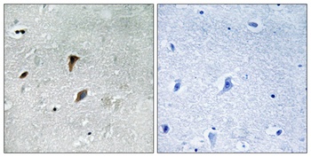 MEK-3 (phospho Thr222) rabbit pAb