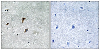 MEK-3 (phospho-Thr222) antibody