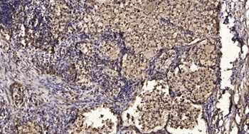 MEK-7 rabbit pAb Antibody