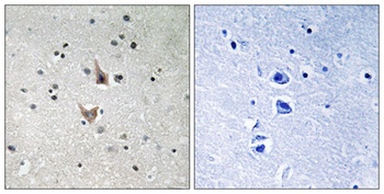Presenilin 1 (phospho Ser357) rabbit pAb